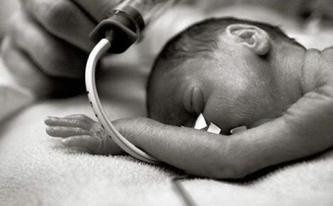 L'œil d'une pédiatre sur les bébés prématurés de son service |  Infirmiers.com